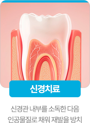 신경치료