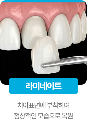 라미네이트